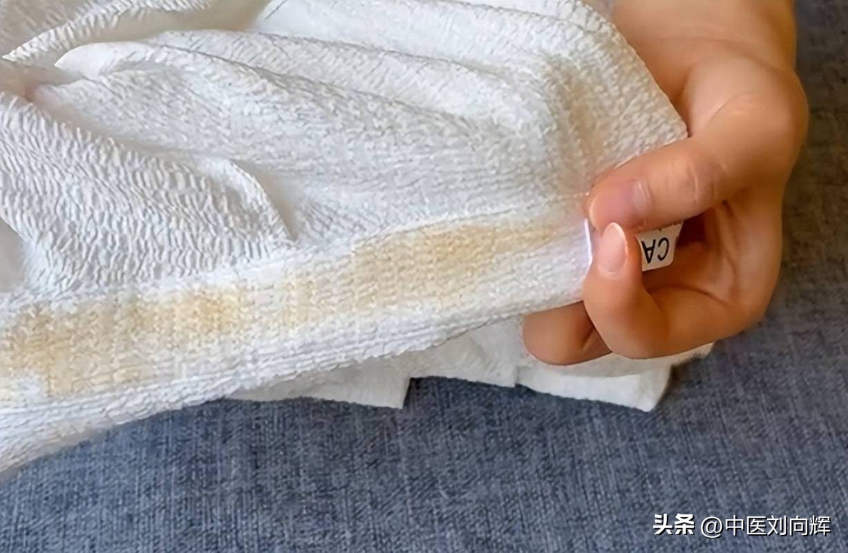 运动出虚汗怎么调理_运动出虚汗是什么原因_运动出虚汗